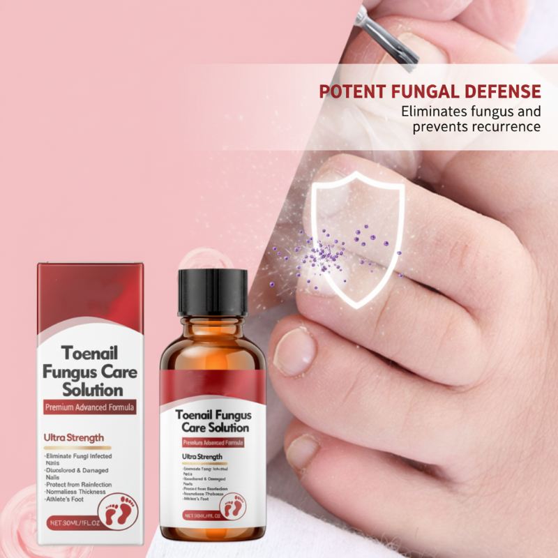 💅🌟 Nail Repair Essence – Strengthens and regenerates damaged nails in 7 days! ✨💪 Visible results, dermatologically tested. Your solution for strong, healthy nails.