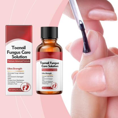 💅🌟 Nail Repair Essence – Strengthens and regenerates damaged nails in 7 days! ✨💪 Visible results, dermatologically tested. Your solution for strong, healthy nails.